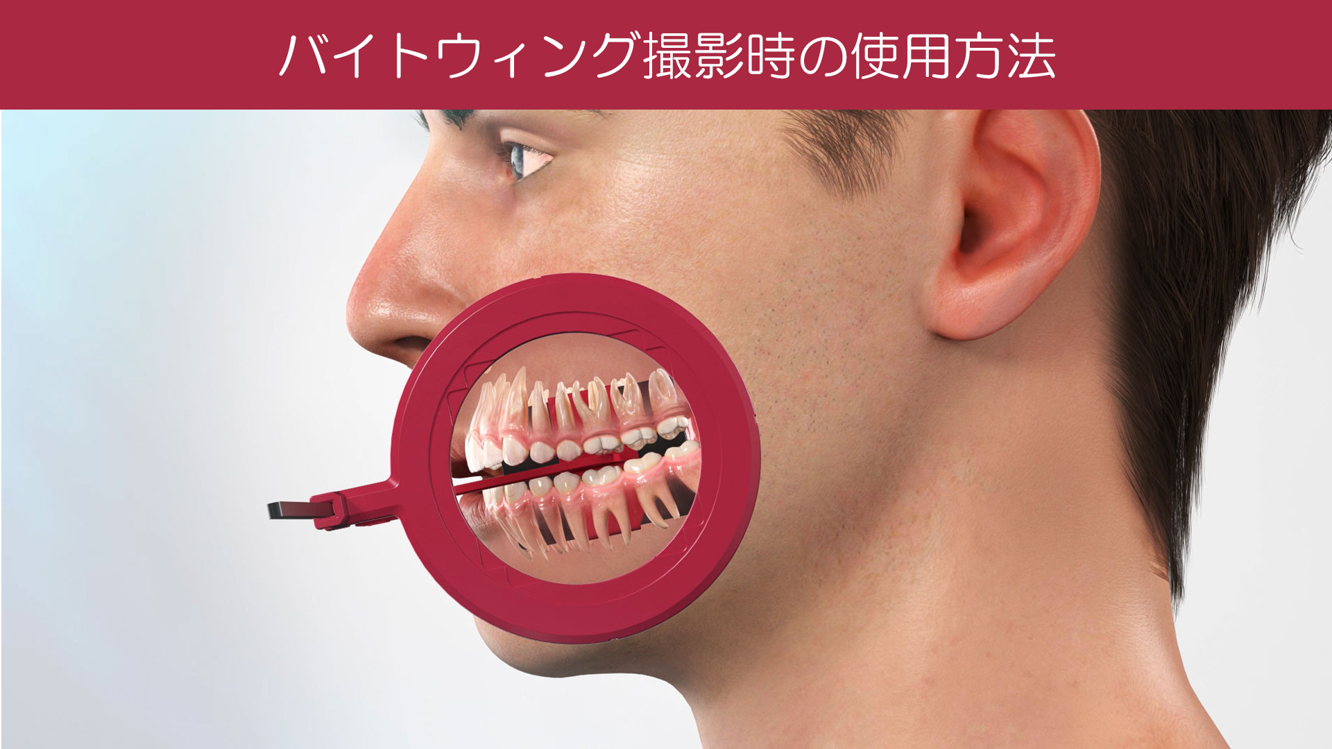 Dürr Dental｜IPフィルムホルダー