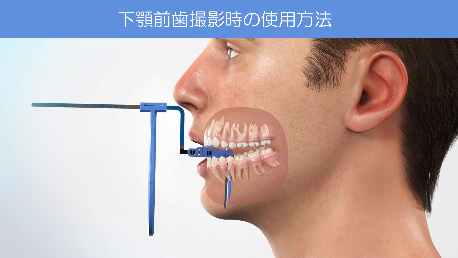 Dürr Dental｜IPフィルムホルダー