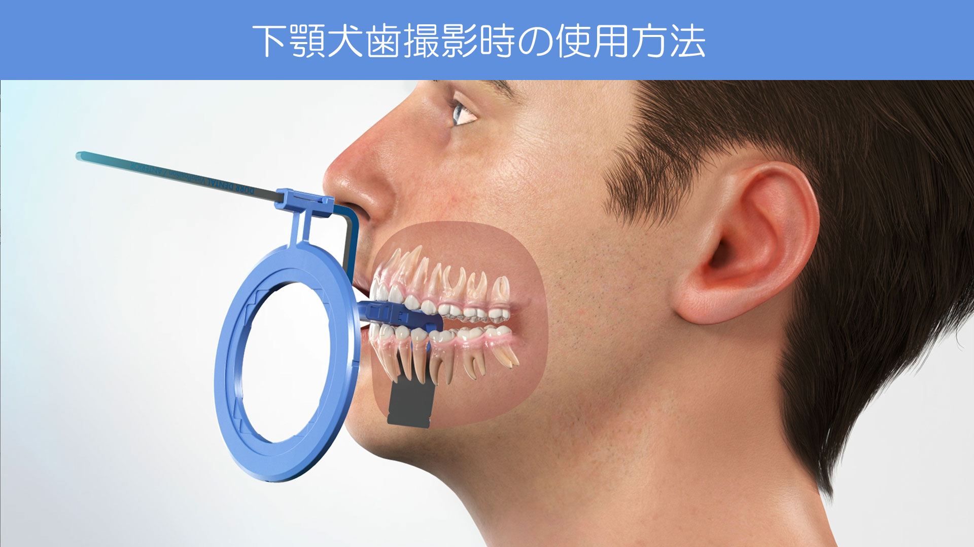 Dürr Dental｜IPフィルムホルダー