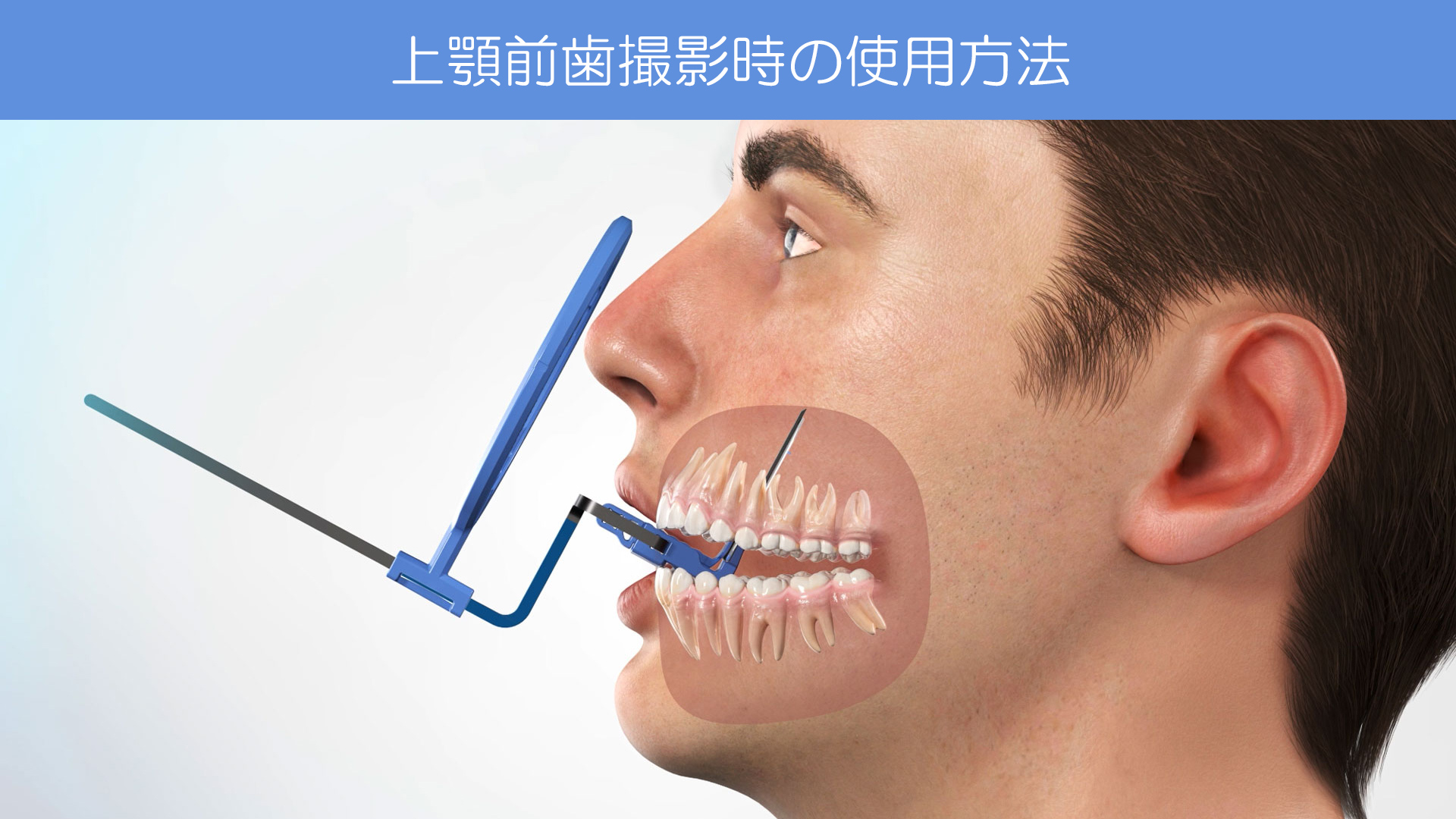 Dürr Dental｜IPフィルムホルダー