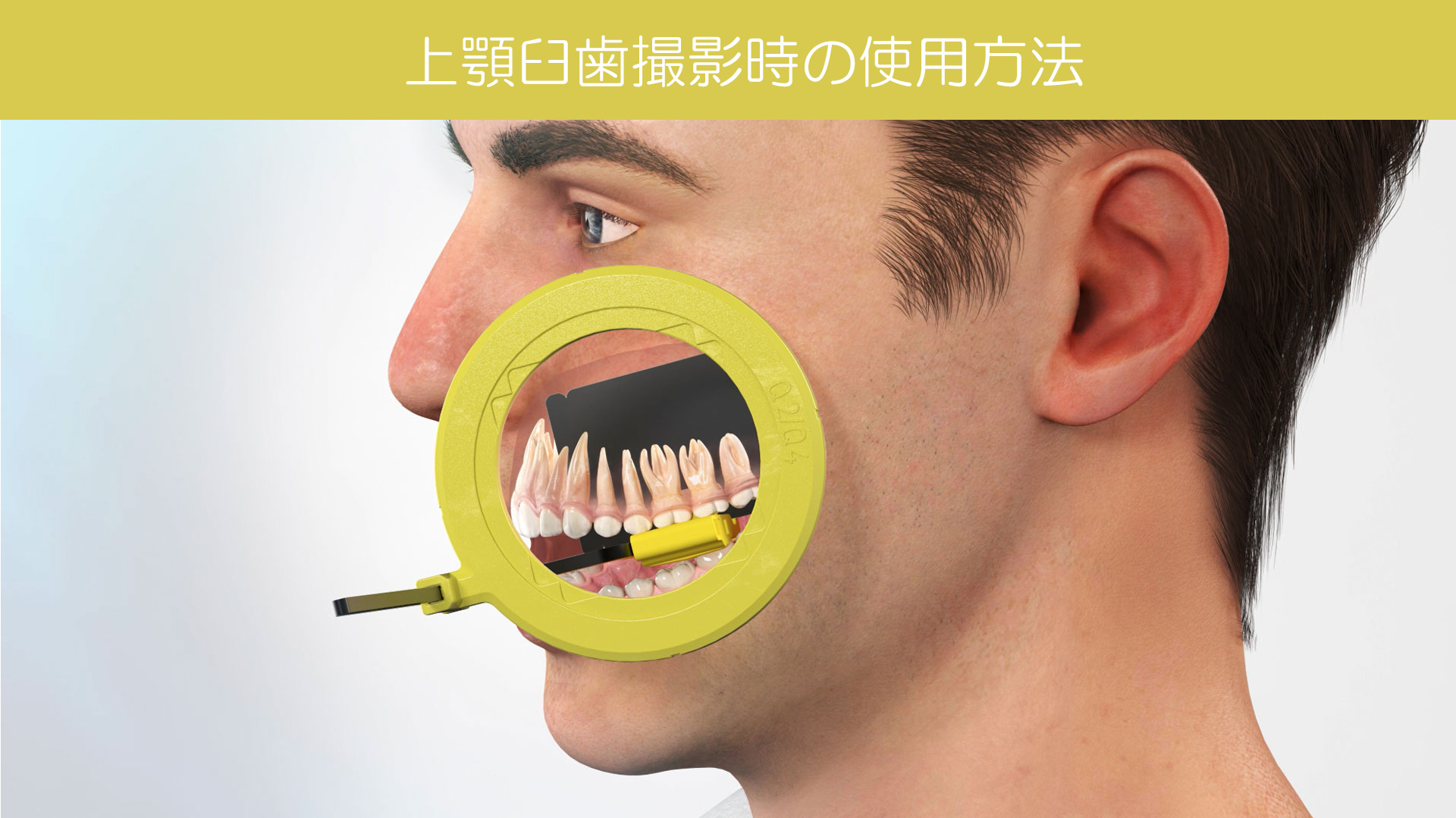 Dürr Dental｜IPフィルムホルダー