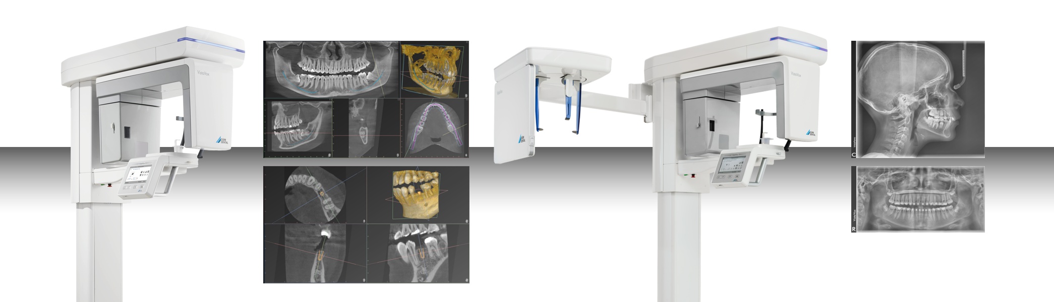 VistaVox S CBCT